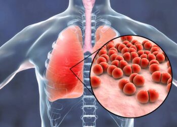 Mengenal Pneumonia Bilateral, Diidap Paus Fransiskus Sebelum Meninggal
