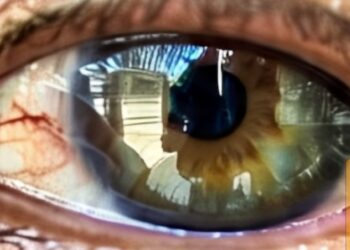 Mengenal Katarak: Pahami Gejala dan Pengobatannya