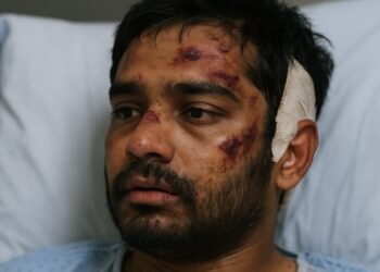 Vishwash Kumar Ramesh menjadi satu-satunya penumpang yang selamat dari kecelakaan pesawat Air India AI-274.