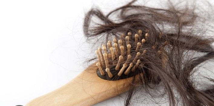 Solusi Rambut Rontok Alami Tanpa Obat