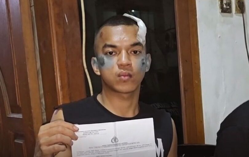Korban begal, Bimo Margo Hutomo, saat mendapatkan perawatan di RS Tarakan, Jakarta Pusat. Korban mengalami luka serius di bagian kepala setelah dihantam batu konblok oleh komplotan pembegal di kawasan Gambir pada Kamis dini hari lalu. Kasus ini kini dalam penanganan intensif Polres Metro Jakarta Pusat. (Foto: Ist/Ekoin)